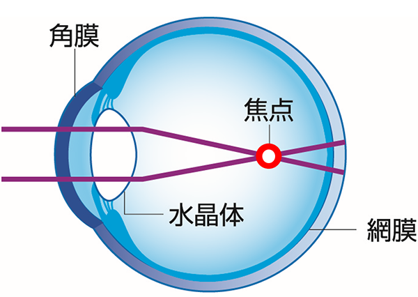 近視の状態