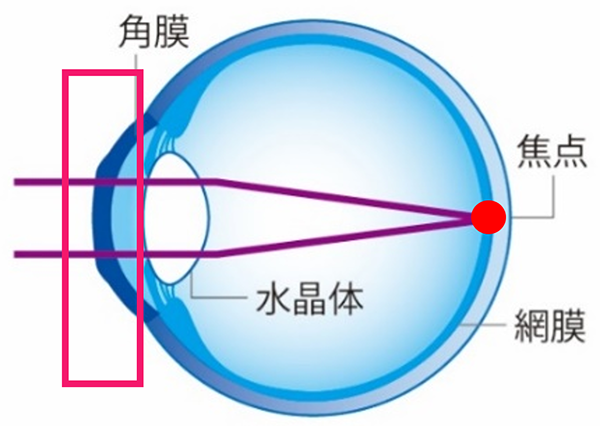 昼：レンズをはずした後